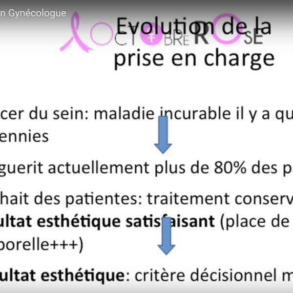 Transcription de la vidéo du Dr Sebban sur les avancées en chirurgie de cancer du sein