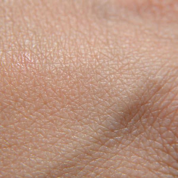 Traitements du cancer du sein : comment gérer les problèmes d’ongles et de peau ?