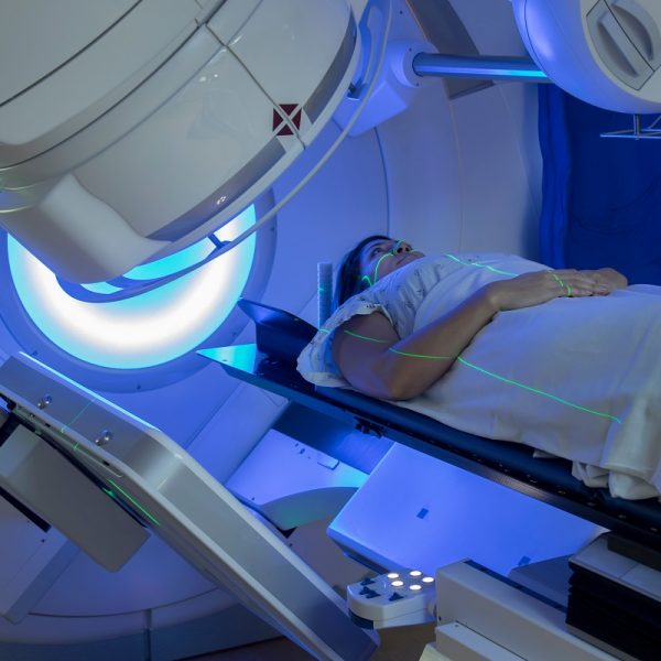 L’irradiation partielle du sein dans le traitement des cancers au stade précoce