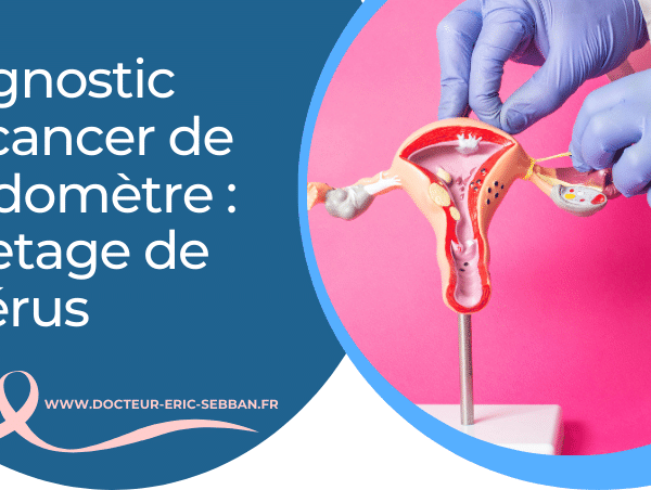 Le curetage de l’utérus dans le cadre du diagnostic du cancer de l’endomètre