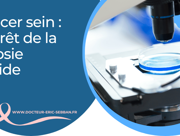 Cancer du sein : l’intérêt de la biopsie liquide pour suivre le traitement et prédire les risques d’évolution