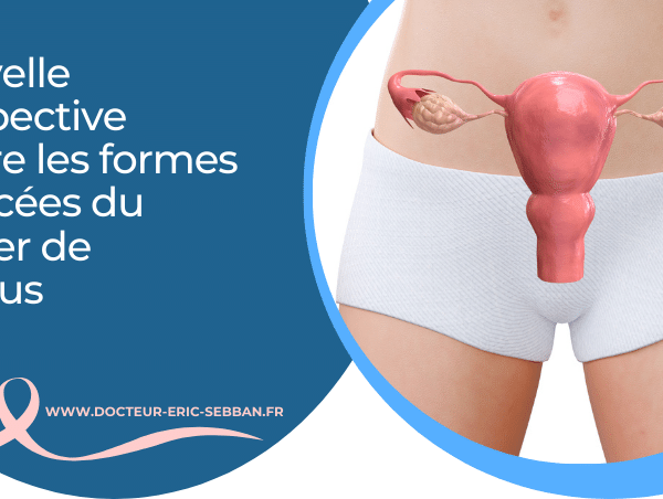 Nouvelle perspective contre les formes avancées du cancer de l’utérus