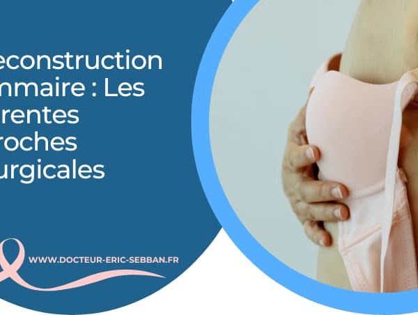 La reconstruction mammaire : Les différentes techniques chirurgicales