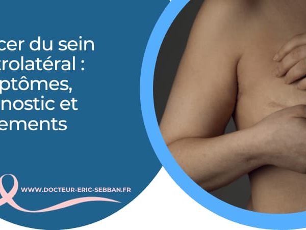 Cancer du sein controlatéral : diagnostic, symptômes et traitements