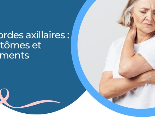 Les cordes axillaires (thromboses lymphatiques superficielles) : symptômes et traitements