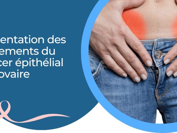 Les traitements du cancer épithélial de l’ovaire