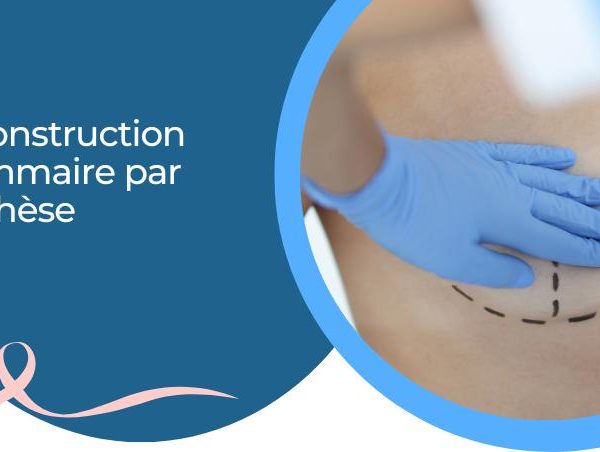 Reconstruction mammaire par prothèse : retrouver confiance en soi après une mastectomie