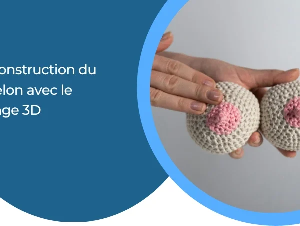 La reconstruction du mamelon avec le tatouage 3D