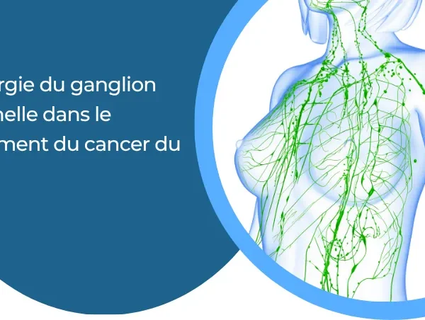La chirurgie du ganglion sentinelle dans le traitement du cancer du sein